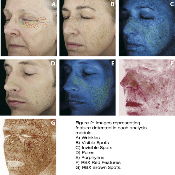 VAESTRO Image Analysis Software for quantitative analysis of facial features