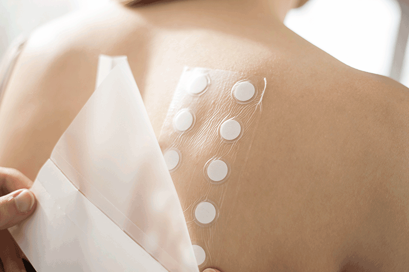 Allergic dermatitis: Inside the world's first DAkkS-accredited patch test