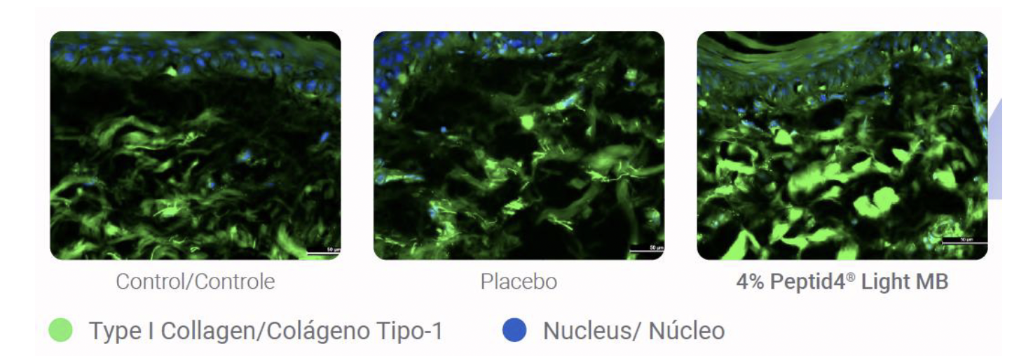 Beyond Tone Uniformity: A New Synthetic Tetrapeptide Targets the Origin of Inflammation in Facial Dark Spots