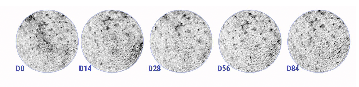 Beyond Tone Uniformity: A New Synthetic Tetrapeptide Targets the Origin of Inflammation in Facial Dark Spots