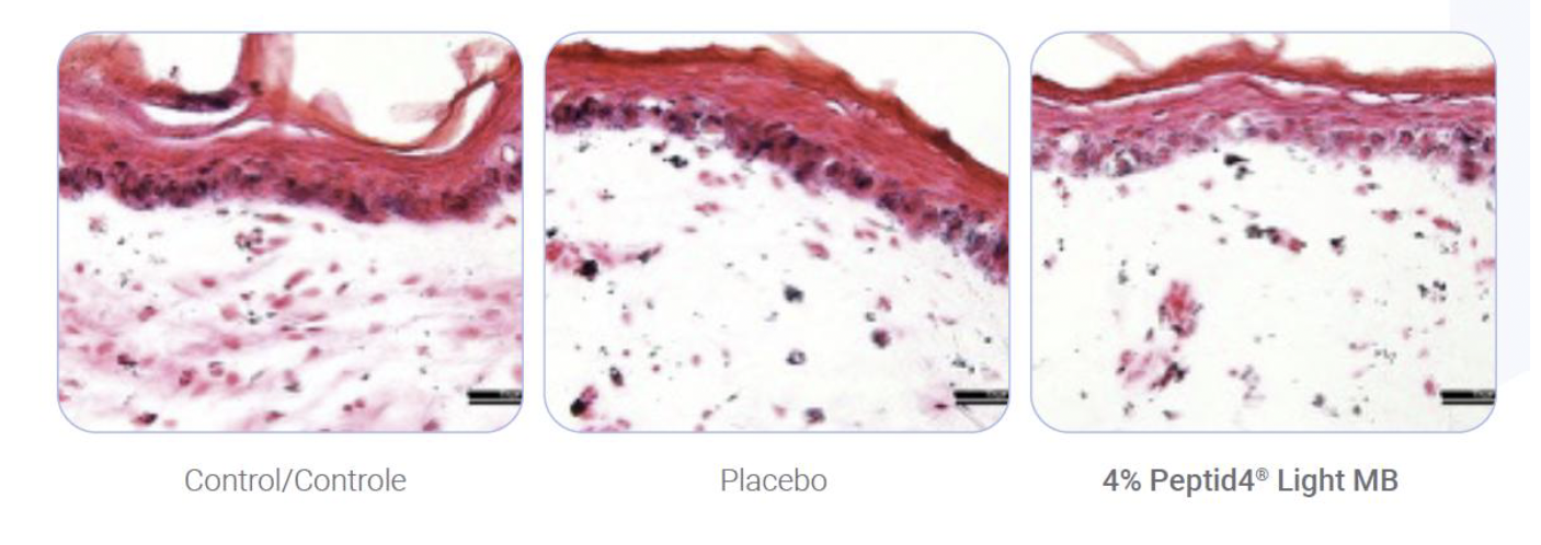 Beyond Tone Uniformity: A New Synthetic Tetrapeptide Targets the Origin of Inflammation in Facial Dark Spots