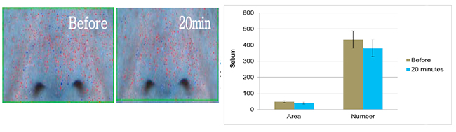 Figure 3. Clinical study of BioDTox on sebum spot.