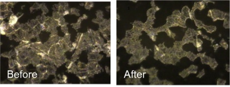 Figure 3. Change of skin scale (dead cell detection by D-Squam) by using a foam cleanser containing 2% BioDTox.