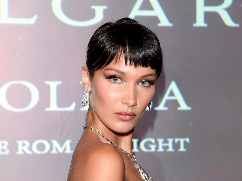 American supermodel Bella Hadid is rumoured to have undergone the buccal fat removal procedure