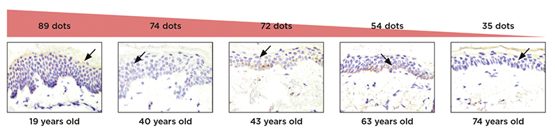 nc886 expression decrease demonstrated with in situ hybridisation on skin explants