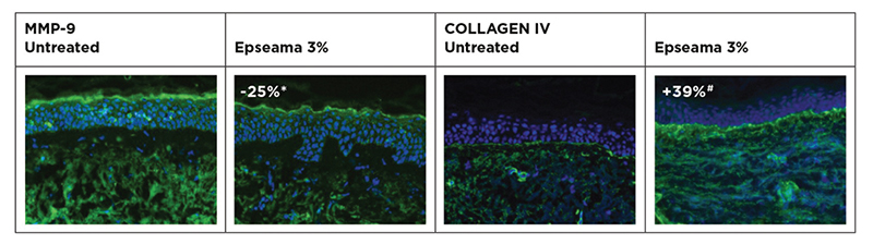 Inhibition of MMP-9 and collagen IV degradation prevention