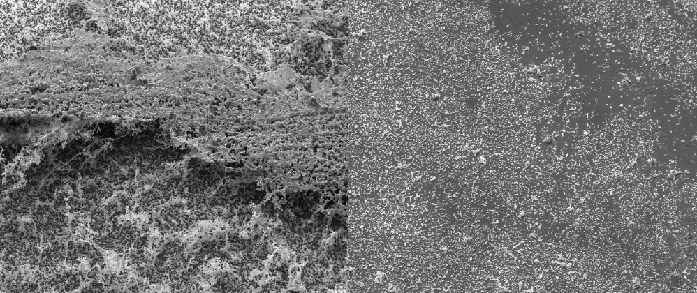 A typical representation of the surface cleansing efficacy of HEC, visualized via scanning electron microscopy