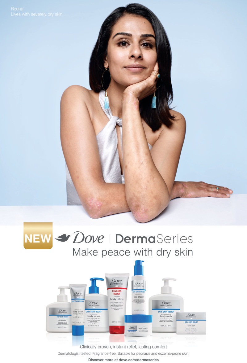 Dove hires models with skin conditions to promote new DermaSeries collection  