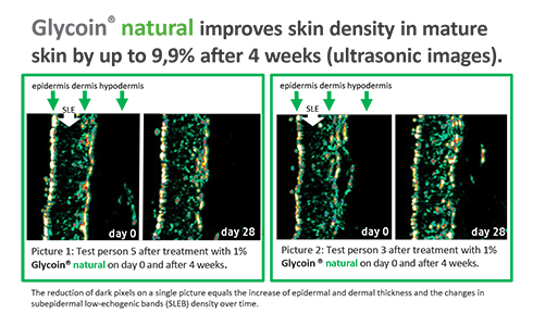 Glycoin Natural - Stimulation of sluggish cell functions