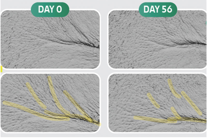 INdermal presents EXO DDS Bakuchiol
