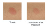 <b>Figure 7: Relief from allergy symptoms</b>