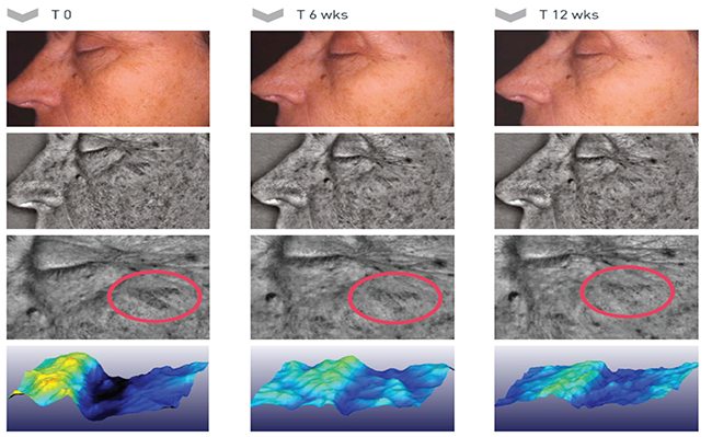 Luminia Granatum PRCF: a synergistic whitening approach