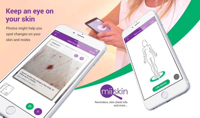 Miiskin donates £5000 to the British Skin Foundation