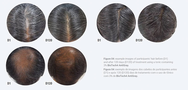 New Postbiotic Biotechnology Stimulates Natural Melanin and Helps Reverse Hair Graying