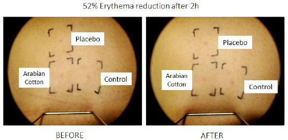 Phyture Biotech exhibits at In-Cosmetics
