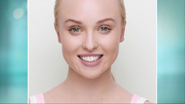 The actress now in her late twenties and acne free / Credit: Proactiv
