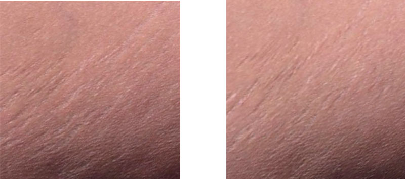 Day 0 vs Day 28