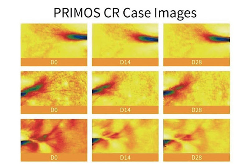 Recombinant PDRN delivers vegan DNA regeneration comparable to salmon-derived PDRN