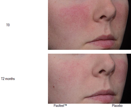 Sederma Pacifeel - skin that feels beautiful