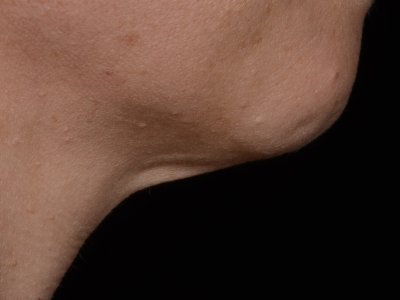 Results after three weeks