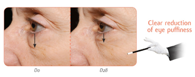 <i>At only 1% usage level, 100% of the subjects shows reduction in the appearance of dark circles</i>