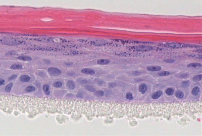 A<br><i><b>Figure 2:</b> Cross section of a 3D epidermal model, established using primary human keratinocytes exposed to UV-induced stress. Topical treatment with a test compound (A) protected cells from UV stress, normal 3D epidermal structure was formed. Above the plastic membrane (bottom layer) the complete epidermal structure is visible, including the basal, spinous, granular and cornified layers. Unprotected control (B) showed incomplete, disrupted morphology</i>