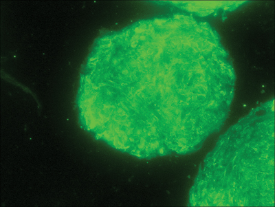 A<br><i><b>Figure 3:</b> (A) Dermal stem cell marker Sox2 (green) detection in dermal papilla derived cells. (B) Nuclear staining (blue) was used as counter stain</i>