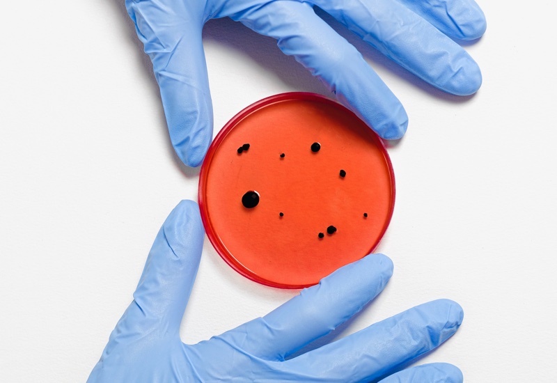 Arxada and Troy merge to create microbial control powerhouse 
