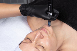 BEAUTYLAB launches peeling and needling webinar