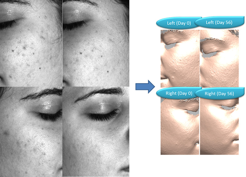 Bionos Biotech introduces new anti-acne efficacy testing at Suppliers' Day