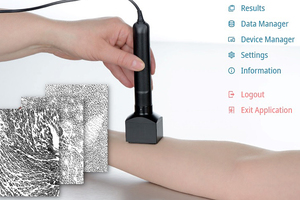 Capacitance imaging new MoistureMap MM 200