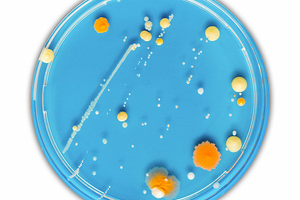 Charles River’s MALDI-TOF ID service now includes filamentous fungi