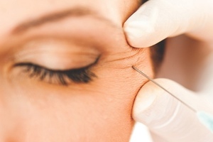 Cosmetic Procedures Market Report: The key trends driving global growth in 2017