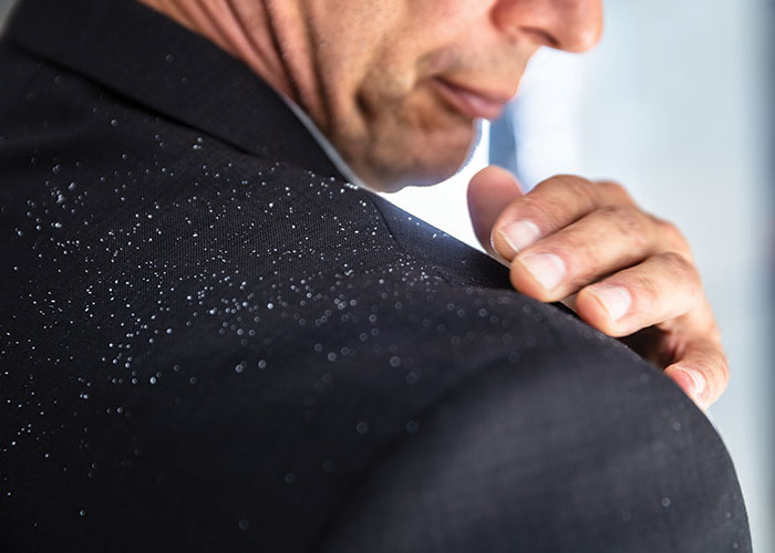 Don’t flake it: Improving scalp health