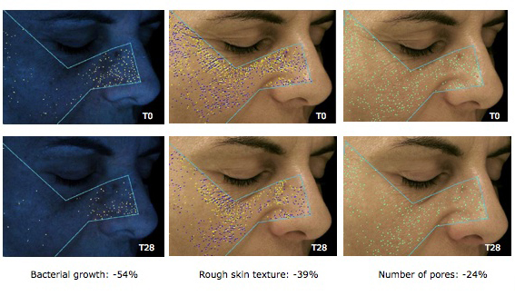 EPIDERMIST 4.0: New Skin Builder