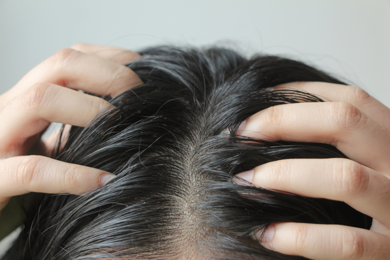 Exclusive: Unilever scientists’ microbiome discovery could pave the way for gender-tailored scalp treatments