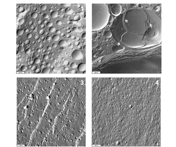 Glycerol-based liposomal systems