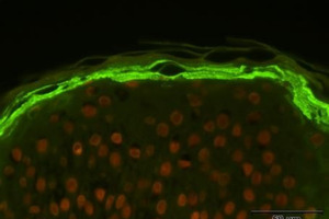Innovating for atopic dermatitis: Cutting-edge solutions by Eurofins