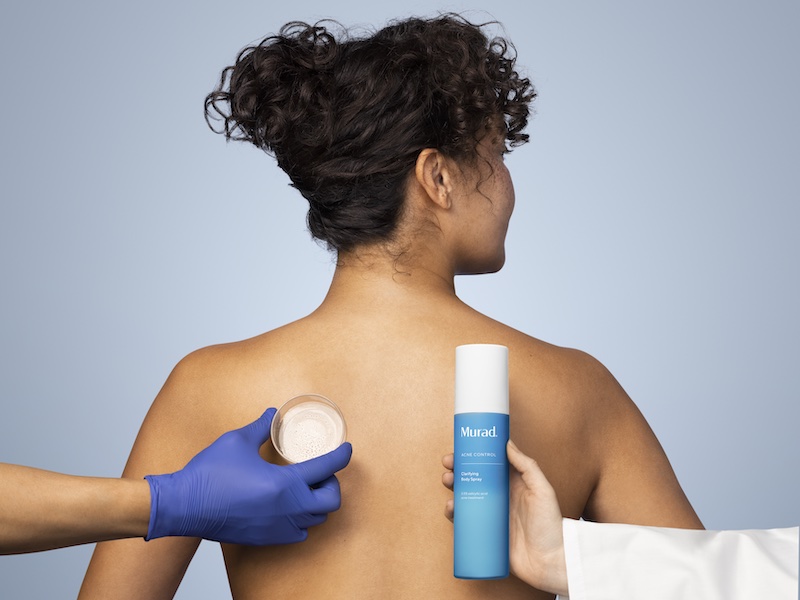 Is beauty’s focus on keratosis pilaris solutions causing more harm than good?