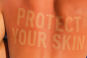 La Roche-Posay warns of dangers of viral ‘burn lines’ trend in new sun safety campaign