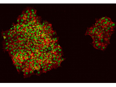 Lab-grown epidermis may offer cosmetic testing alternative