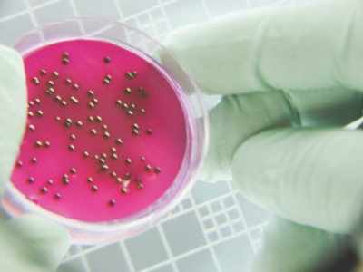 Microbiological control goes beyond the lab