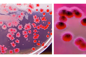 Microbiological quality of cosmetic products