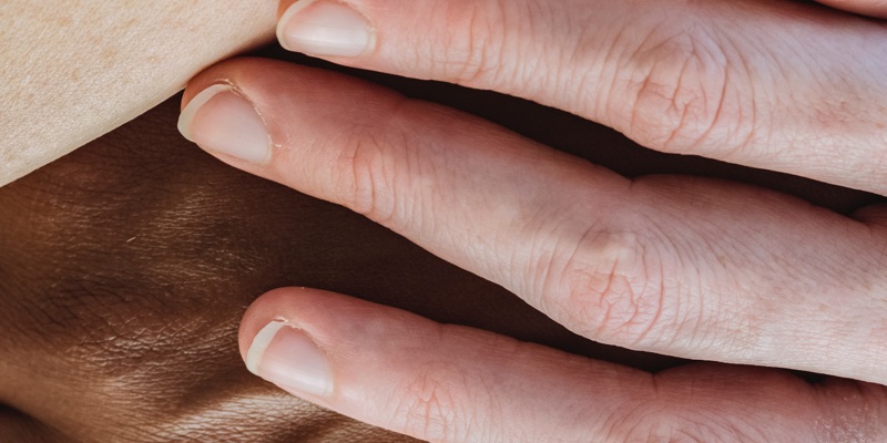 New way to describe skin colours will combat underrepresentation in research
