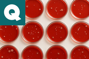 Preservative challenge testing for cosmetics: proven safety with scientific precision