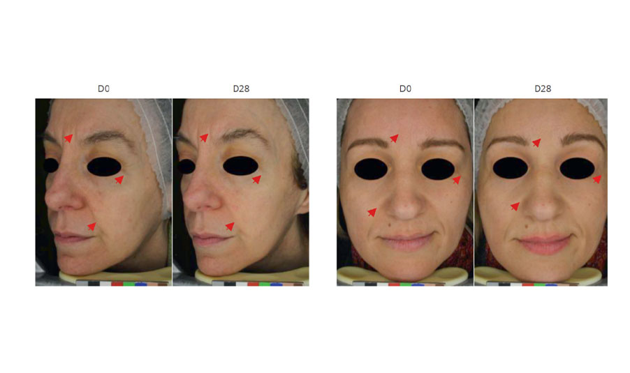 Primadulcine: the spring of your skin