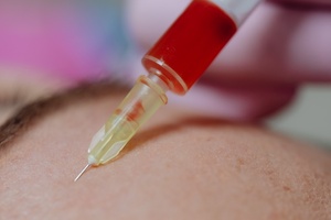 Regulate non-surgical cosmetic procedures within a year, MPs urge UK government 
