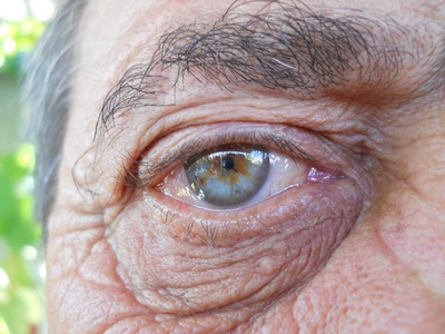 Researchers reveal how fat cells could banish wrinkles 