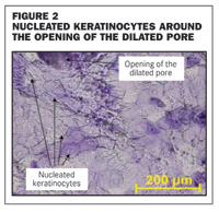 Skin care – The refinement of pores