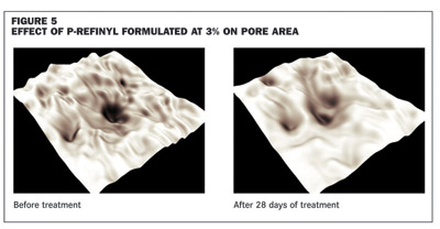 Skin care – The refinement of pores